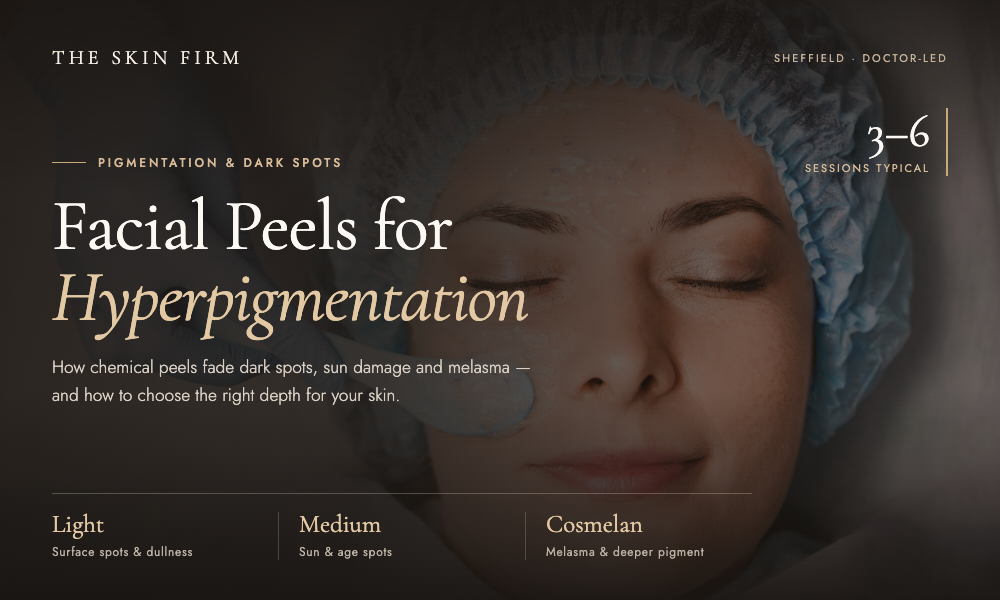 Facial Peel for Hyperpigmentation: A Clear Skin Guide