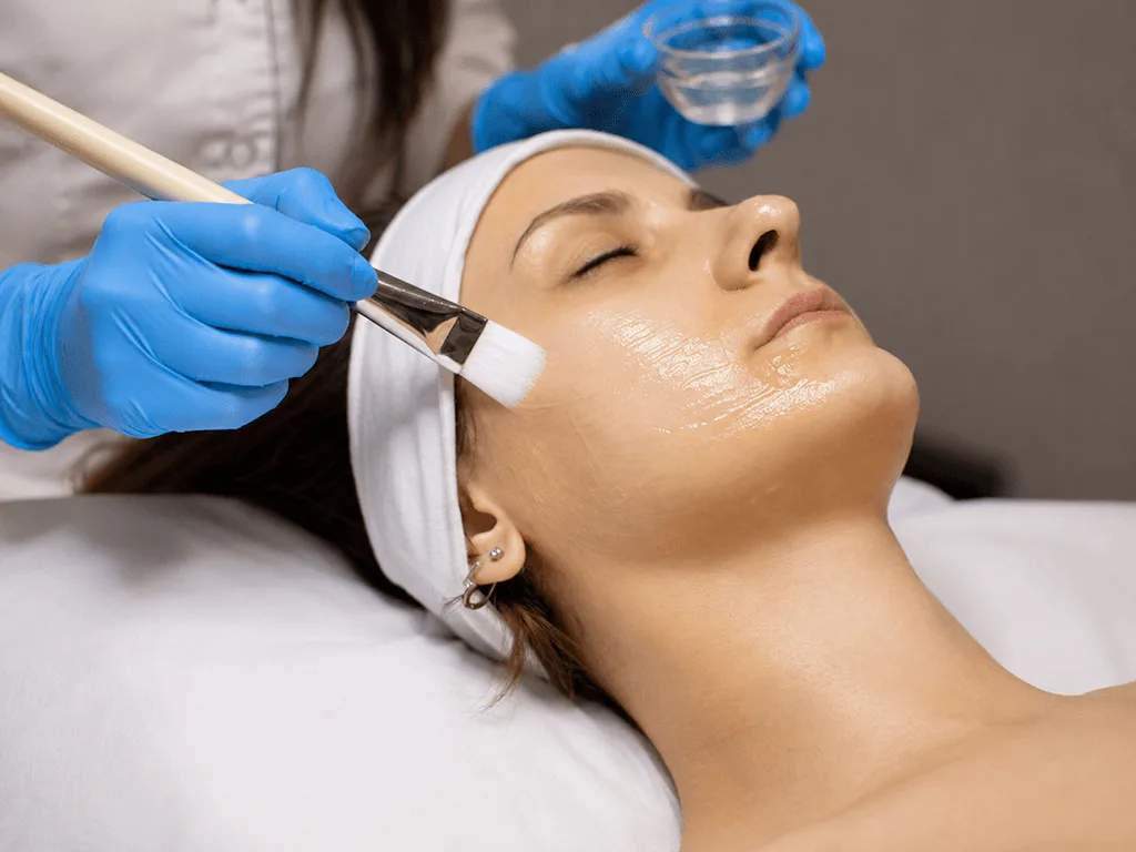 Chemical Peels for acne at The Skin Firm Sheffield
