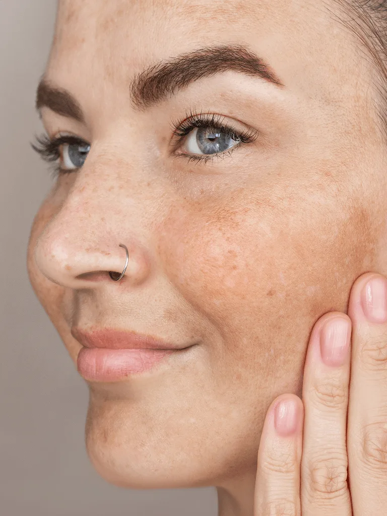 The science behind Cosmelan treatment at The Skin Firm Sheffield