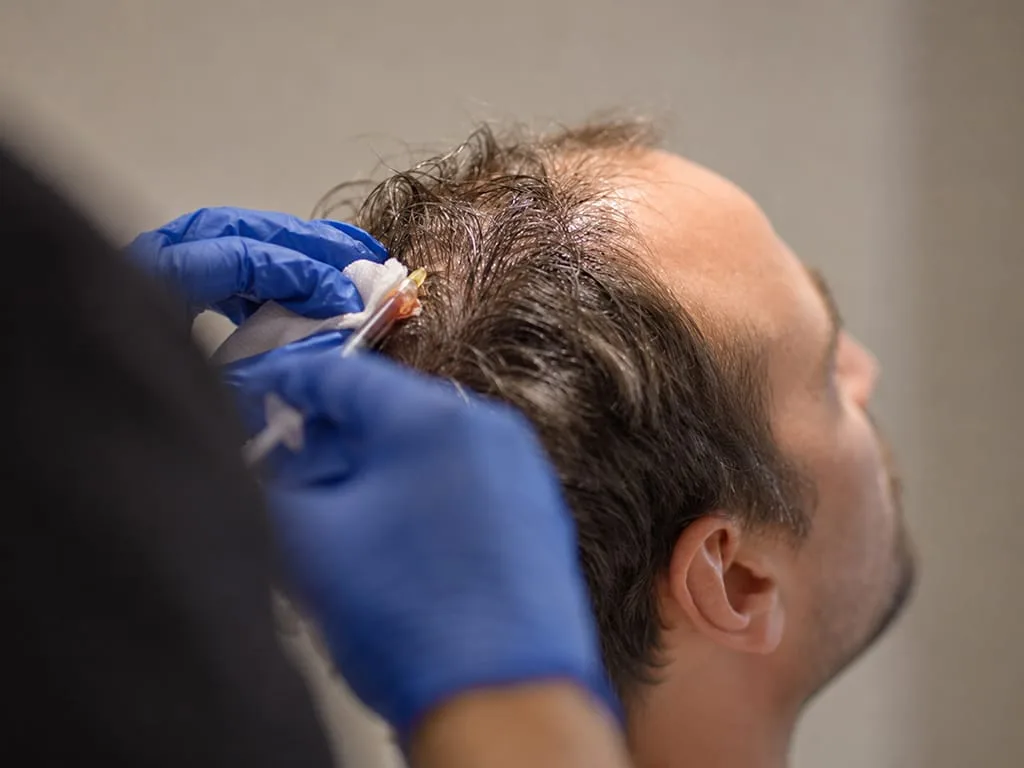 Hair Loss Treatment