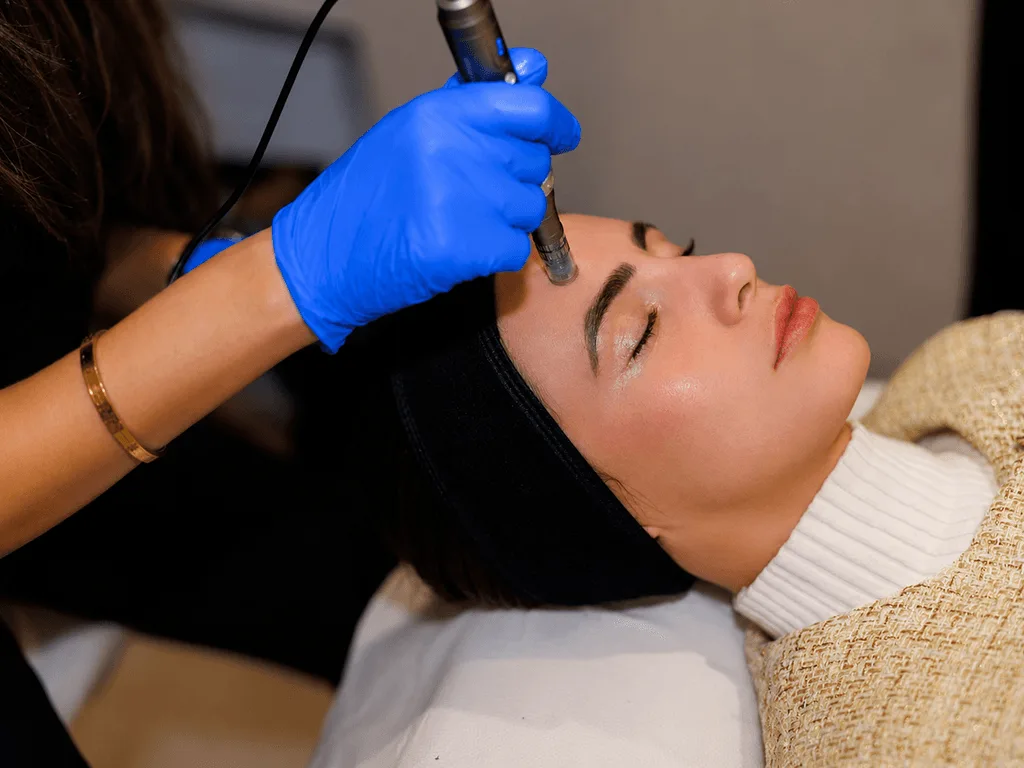 Microneedling treatment at The Skin Firm Sheffield